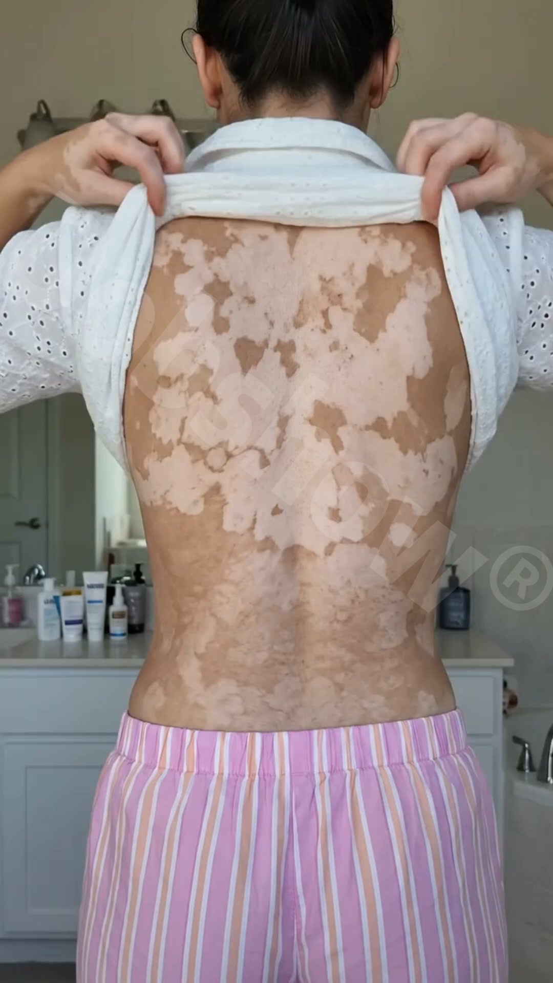 Ready to Stop Covering Up? Start Your Daily Pigment Care Today!