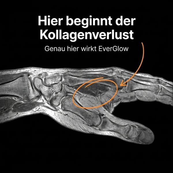 Langarm. Schal. Fotos vermieden... Nie mehr.