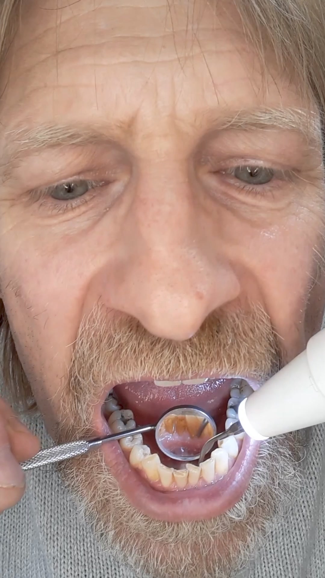 Designed for Back Teeth