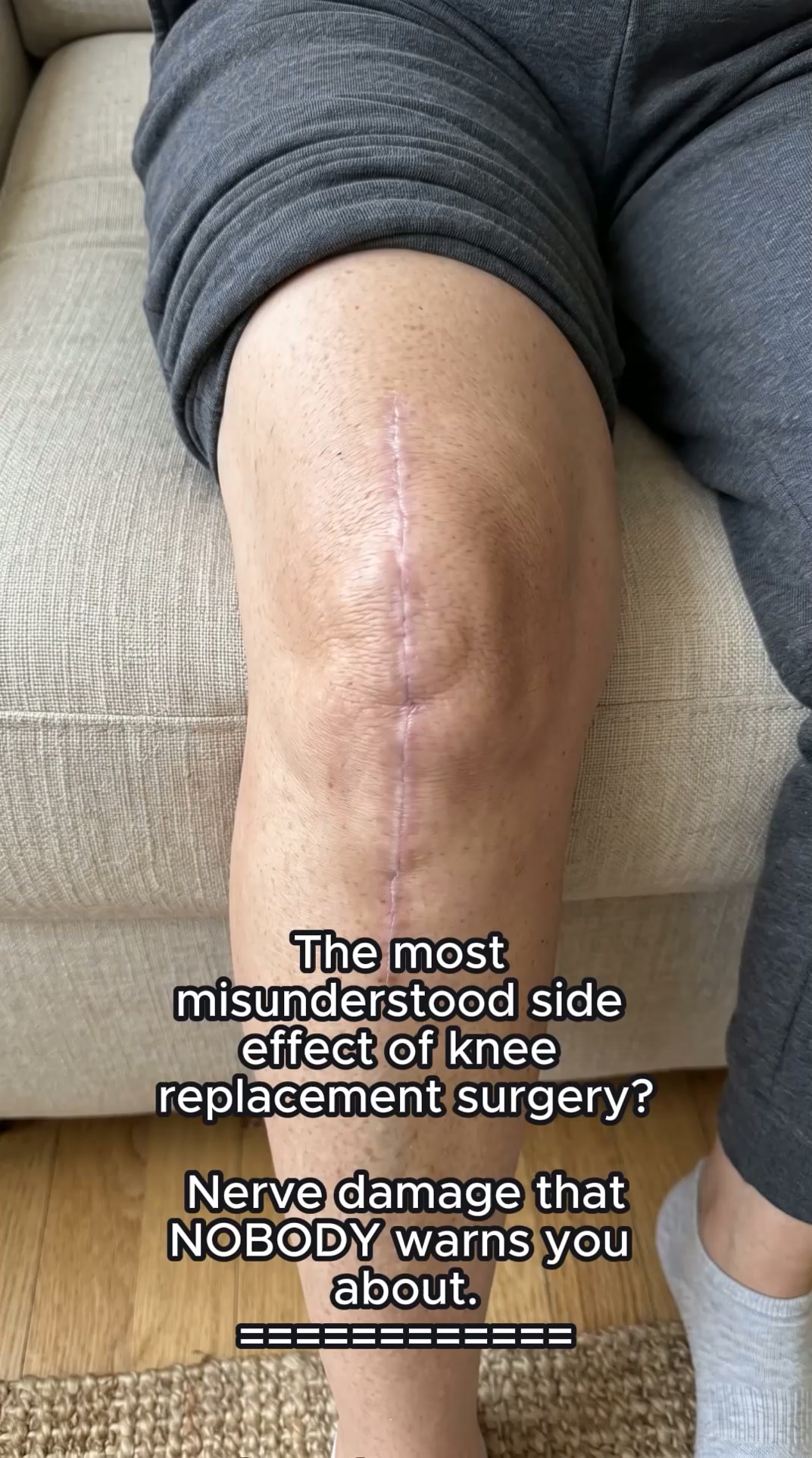 The nerve pain relief that my doctor missed!