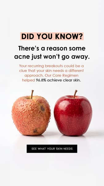 Maybe It Isn’t Just Stubborn Acne