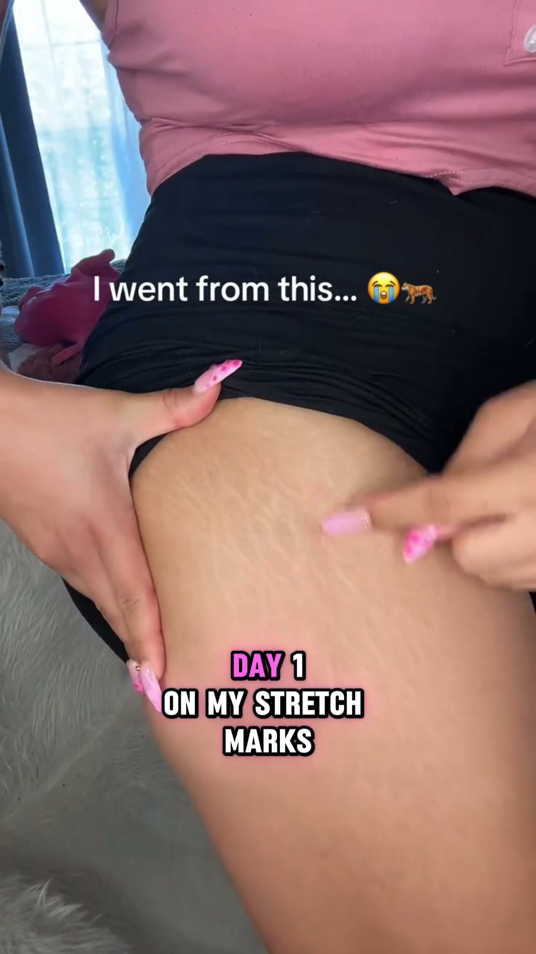 Firmer-Looking Skin in Just Weeks