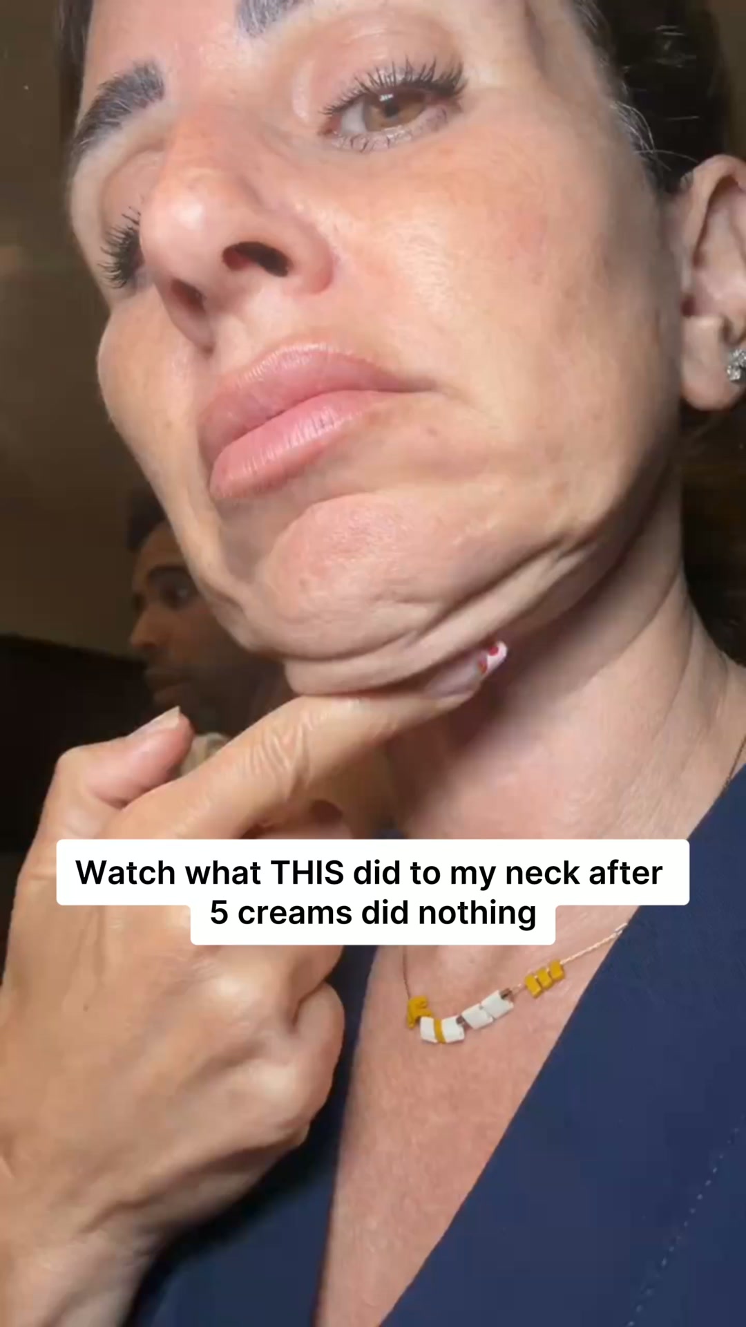 Nobody Tells You Why Neck Creams Stop Working