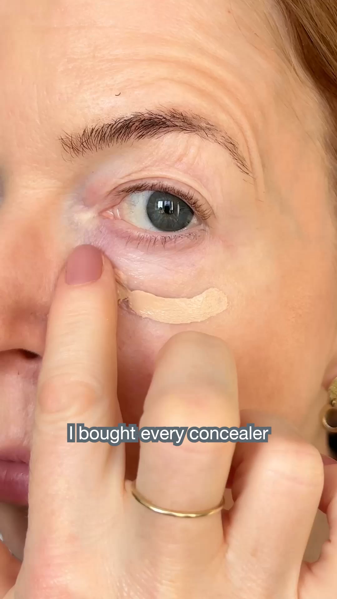New Smart Eye Density
