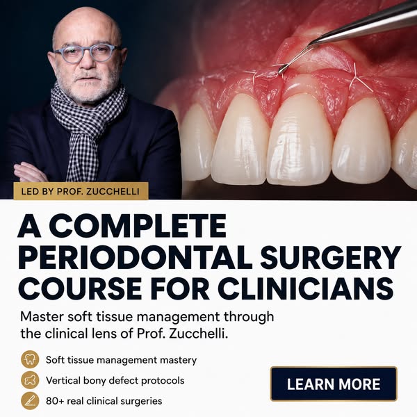 Zucchelli Channel — Master Periodontal Surgery