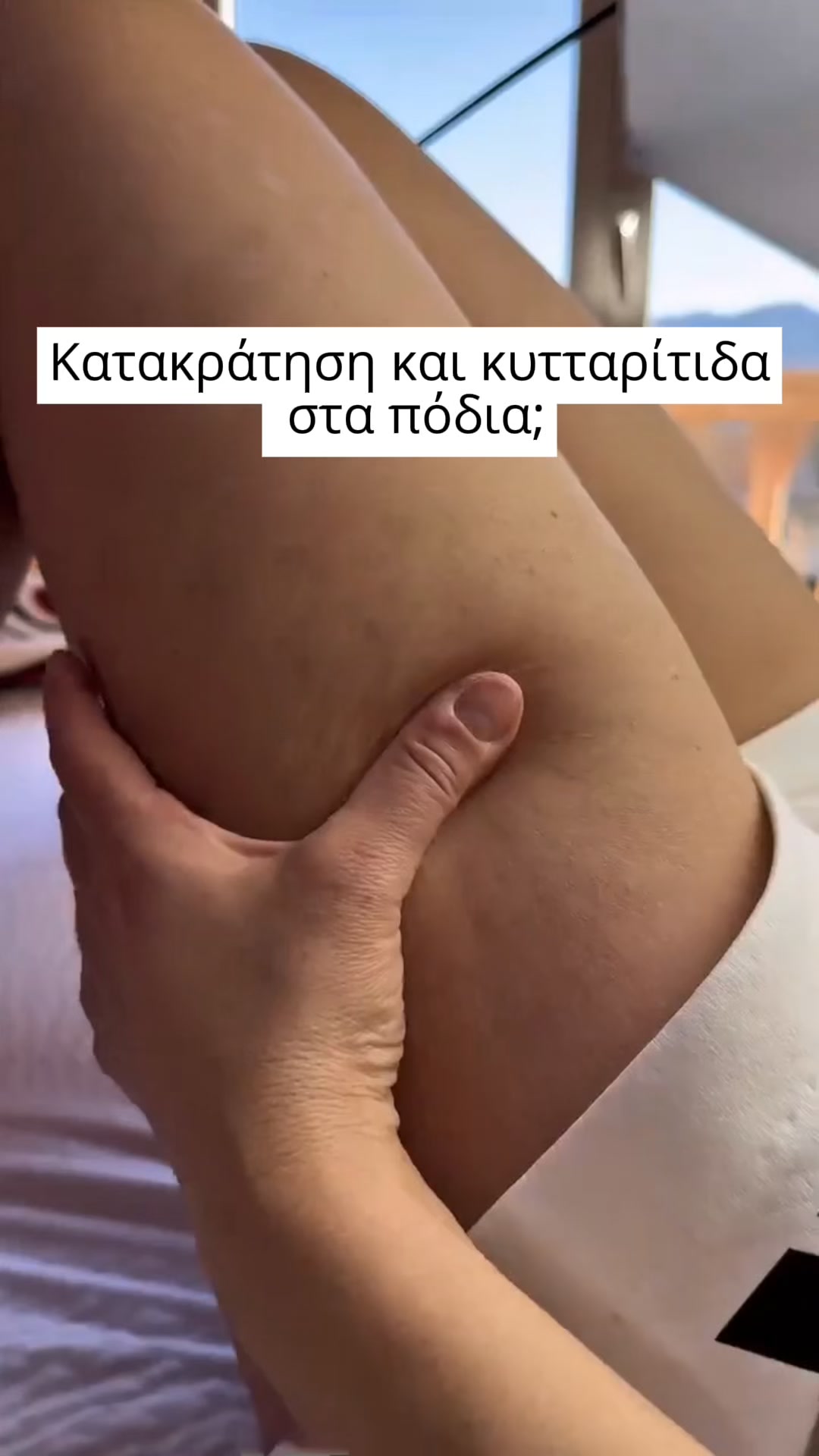 Πιο Λεία Όψη, Λιγότερο Έντονη Κυτταρίτιδα