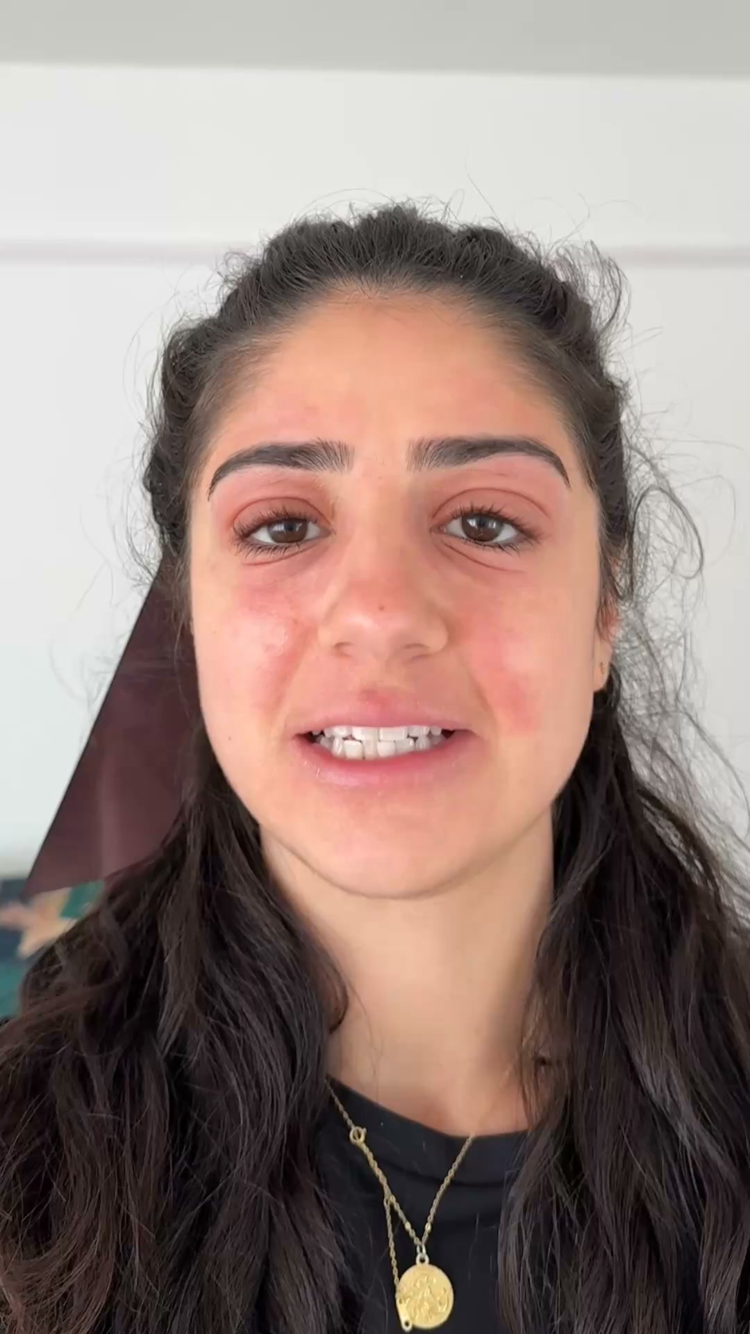 What's Causing Your Eyelid Eczema?