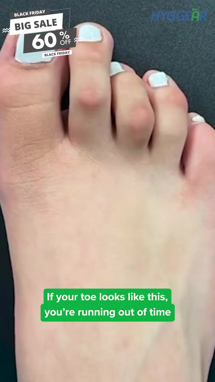 HOW TO GET RID OF FOOT NUMBNESS?
