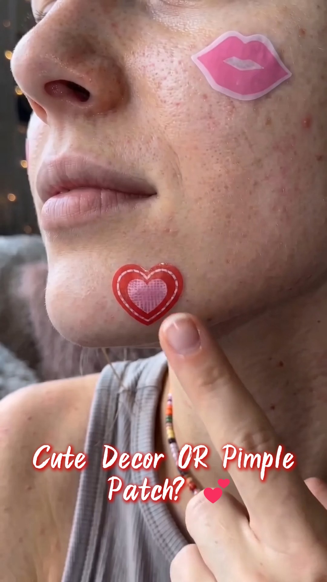 Breakout-Friendly Glitter Shaped Acne Patches 24pcs Cover Red Blemishes As Cute Face Decor