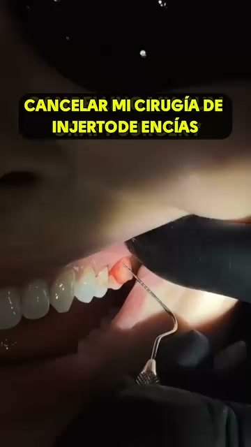 Sensibilidad fuera en 24 horas