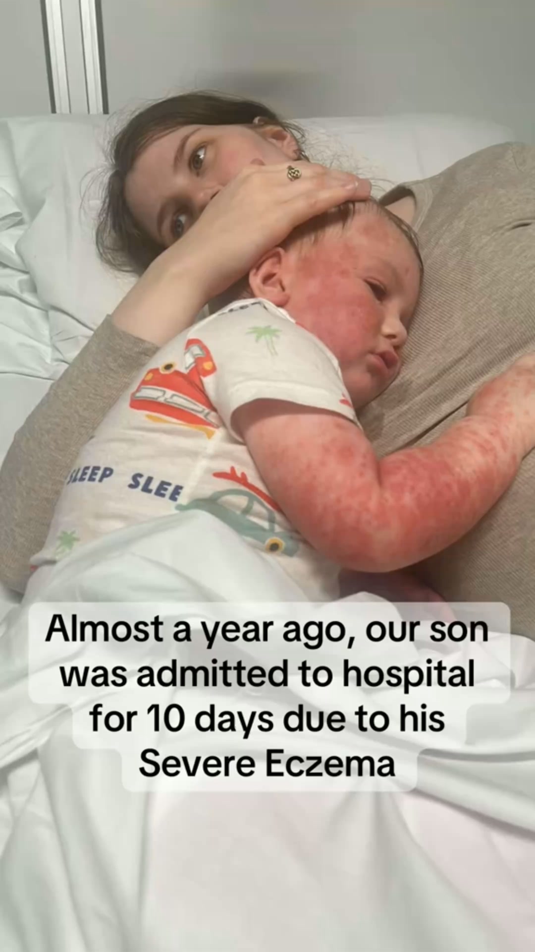 Clear Your Baby's Eczema in 30 Days — Or Your Money Back.