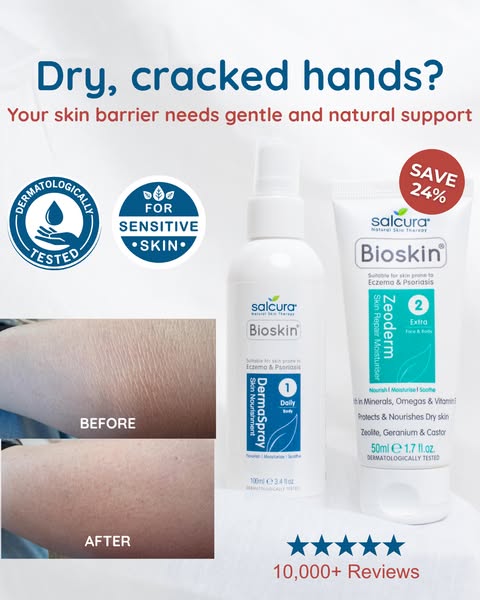 2-Step Spray-Cream Therapy System
