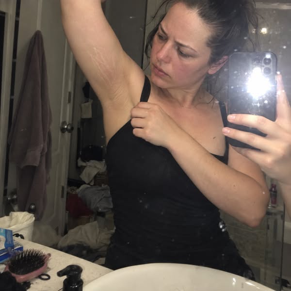 The Viral Gold Gel I Use On My Stretch Marks