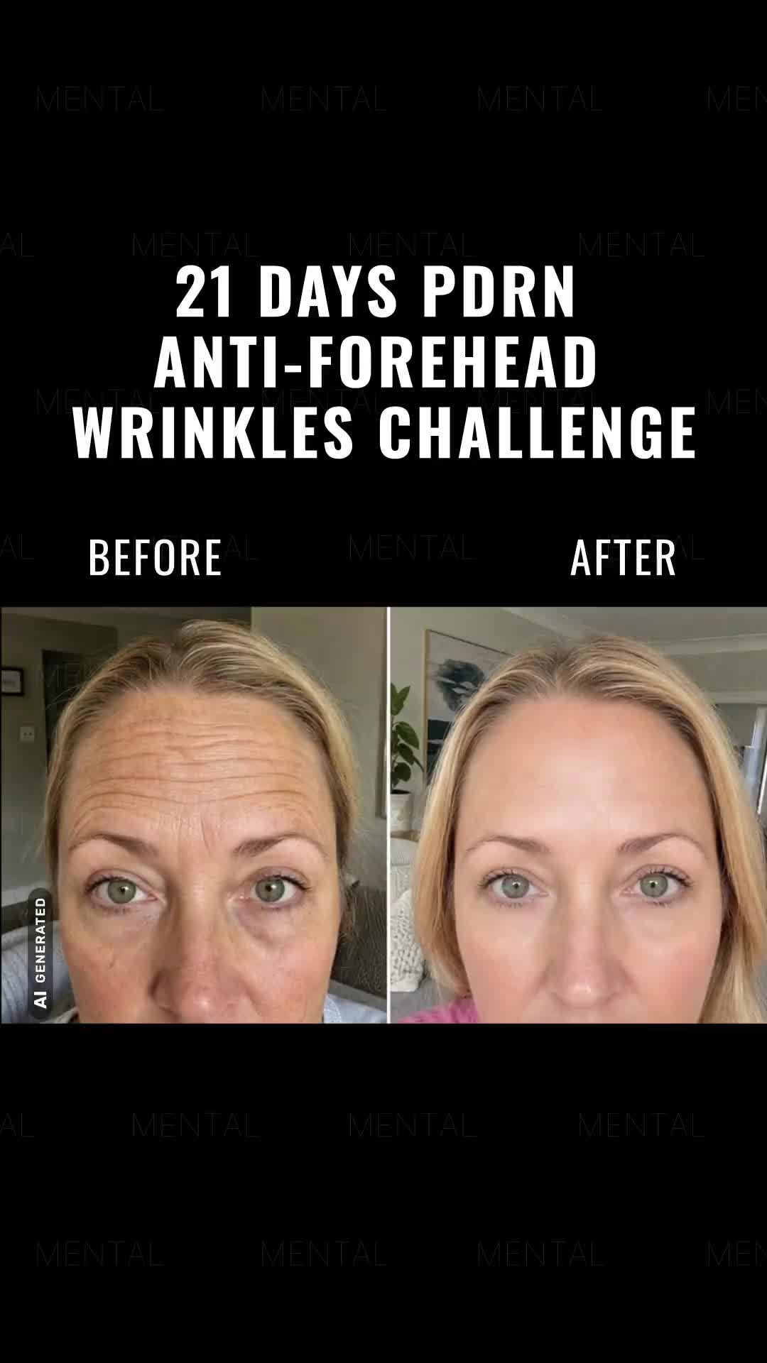 Start Now