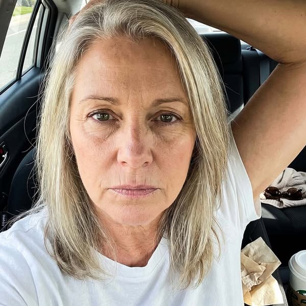 What concealer never fixed