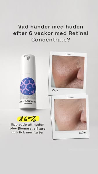 86% upplevde en jämnare hud