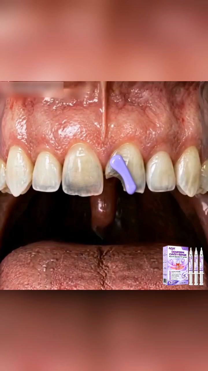 Stronger-Feeling Enamel with AQA®