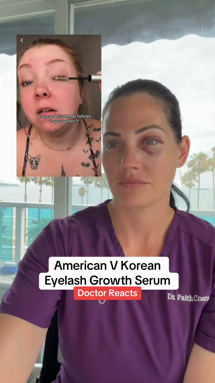 Visibly Longer, Thicker Lashes In Just 14 Days | Prostaglandin-Free Serum