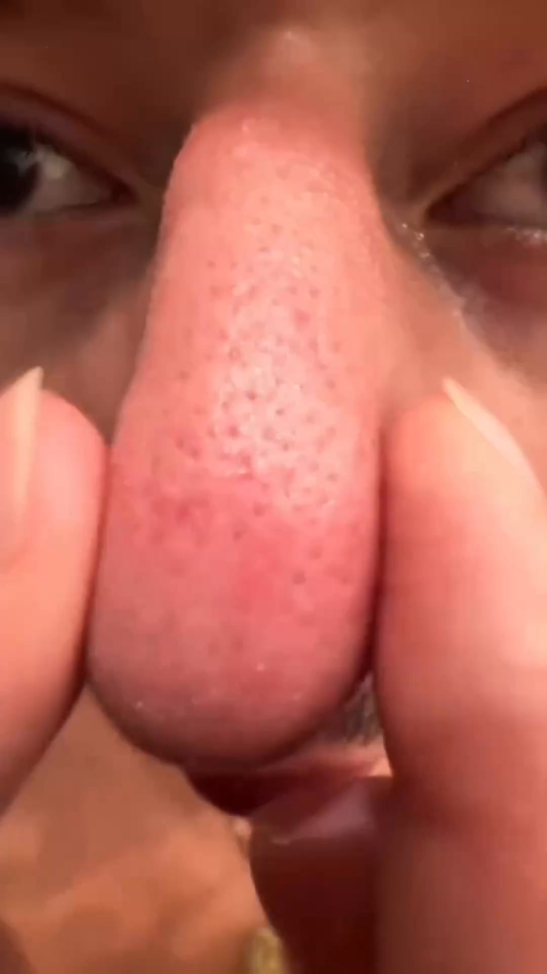 Say goodbye to blackheads