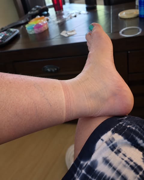 Tired of swollen, heavy legs? Read this
