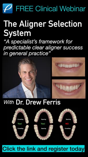 5 Questions to Ask Before Starting Aligners