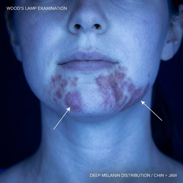 Read this if you're shaving your face daily