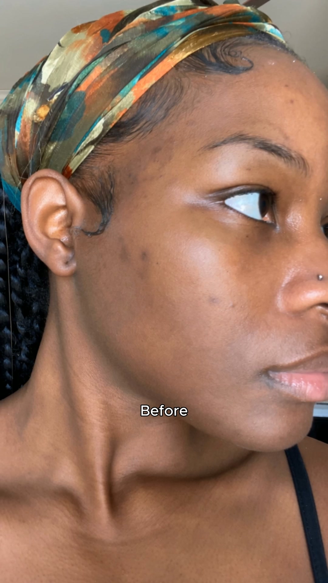 Bright Skin, Simplified