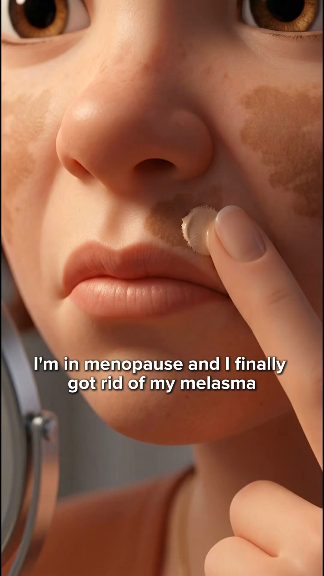 Stop Covering Melasma With Makeup, Do This Instead