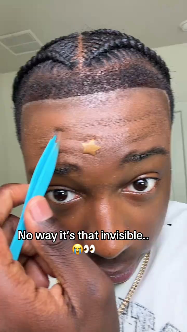 Pimple Patches That Disappear Under Makeup