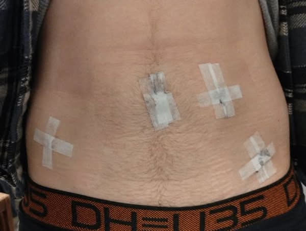 GPs are trained to treat thinning hair and bladder leaks. Not to explain the link.