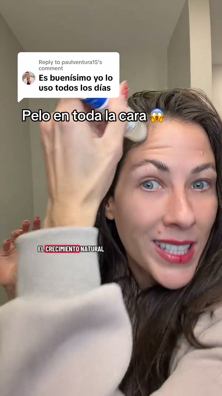 Deja de quedarte calvo