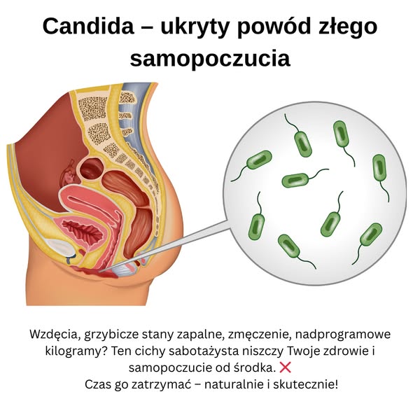 Candida – ukryty powód złego samopoczucia.