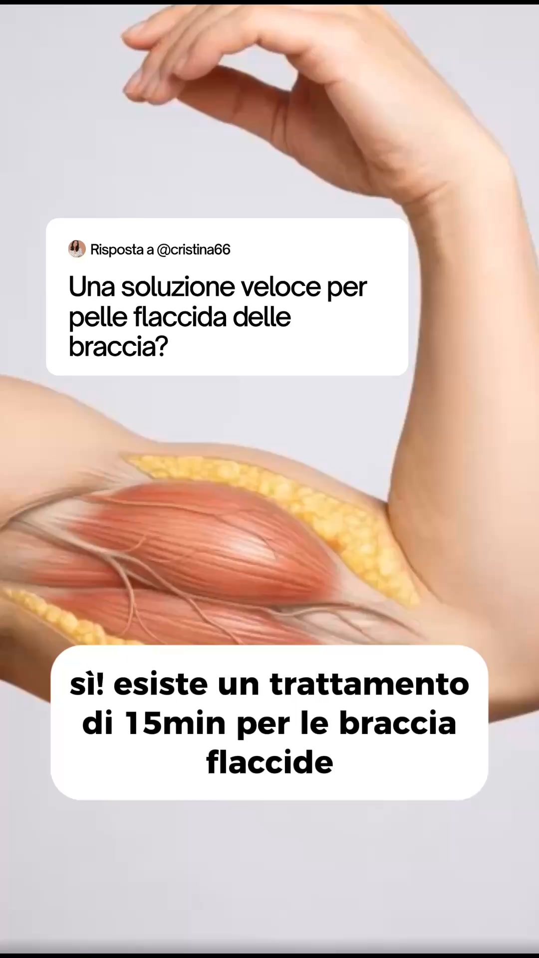 FAI IL QUIZ GRATUITO