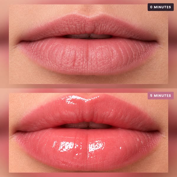 My Lips Came Back to Life!