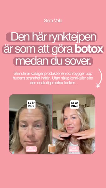 Du behöver inte botox för att minska rynkor.