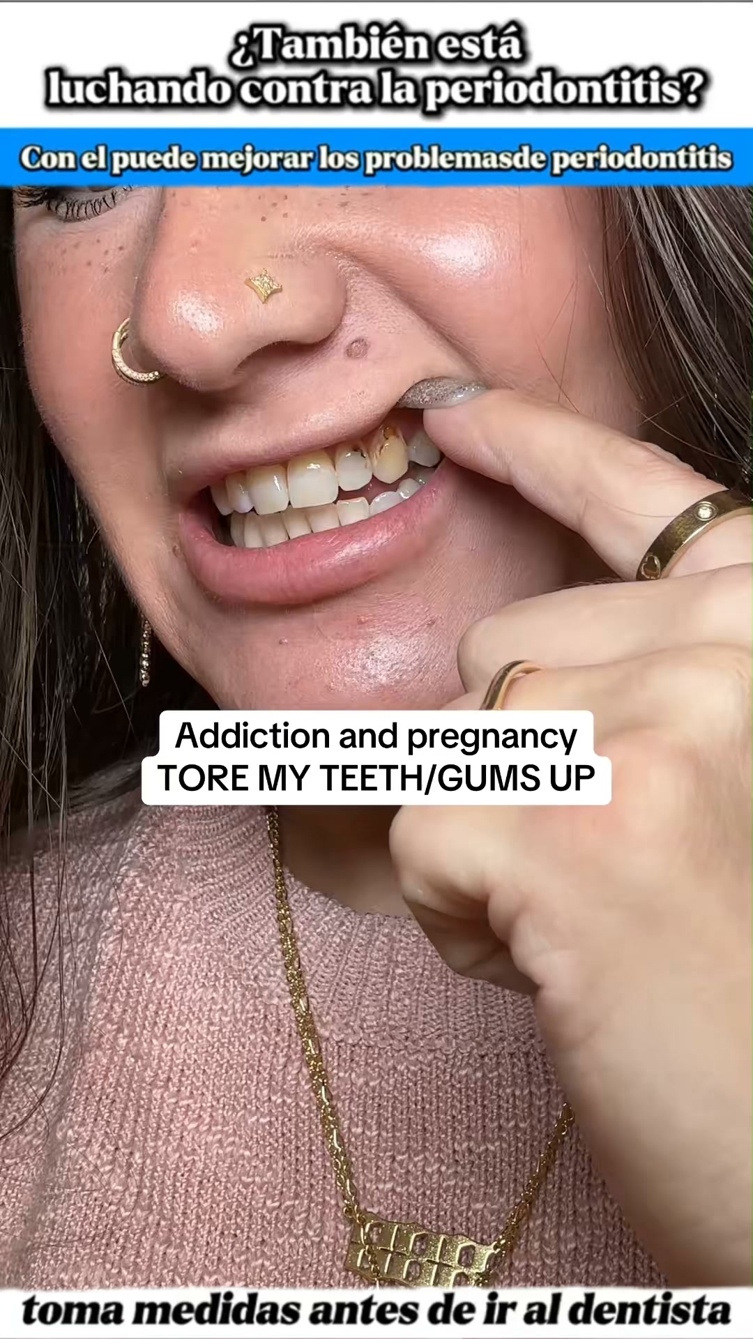 Give Your Enamel a New Life!