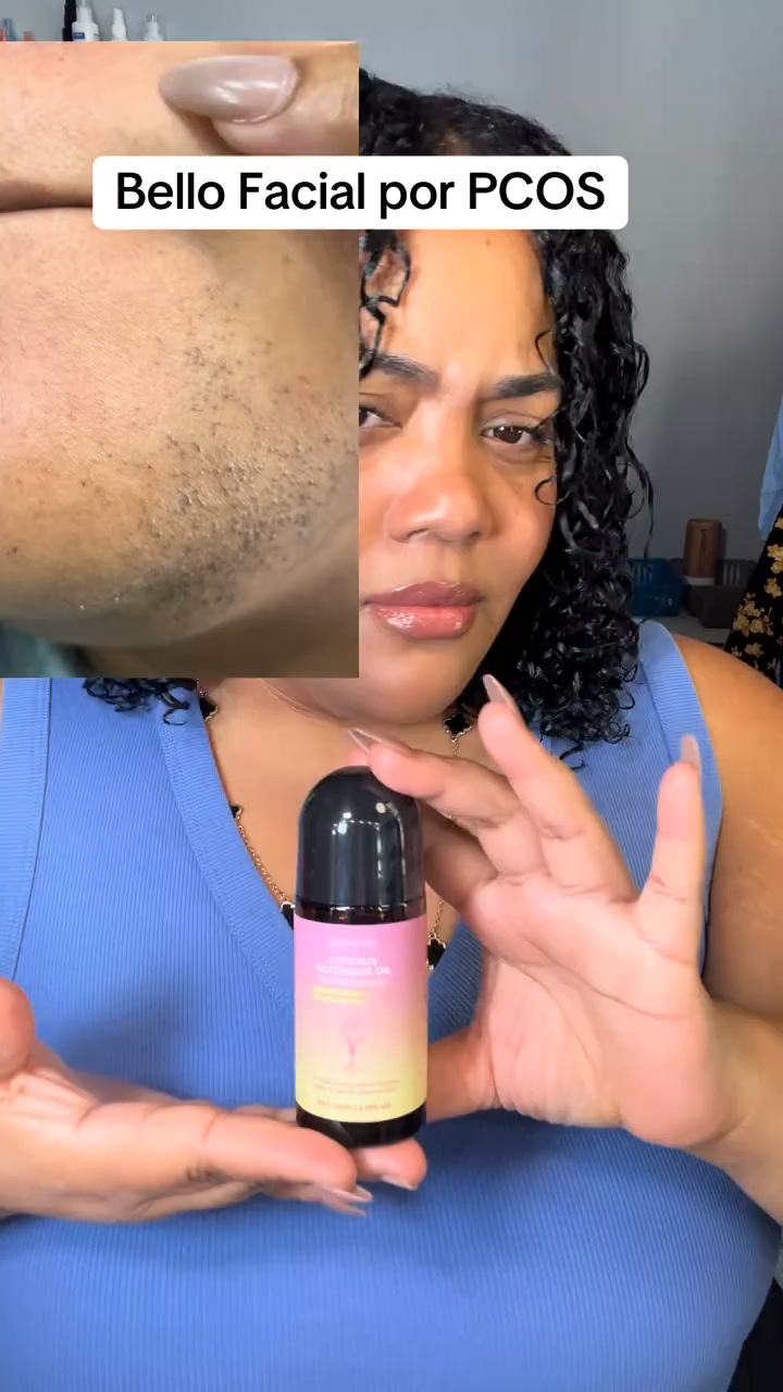 Detén el vello con esta raíz extraña