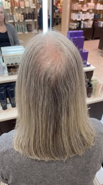 I saw the back of my head. Then I didn't mind.