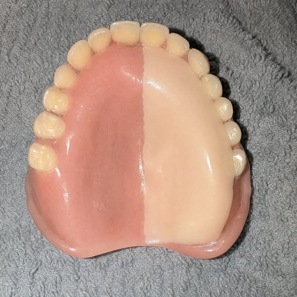 Read this if you wear dentures