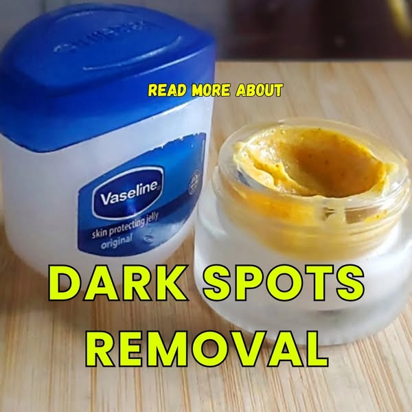 Learn more about dark spots removal