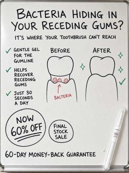 My Gums Kept Pulling Back