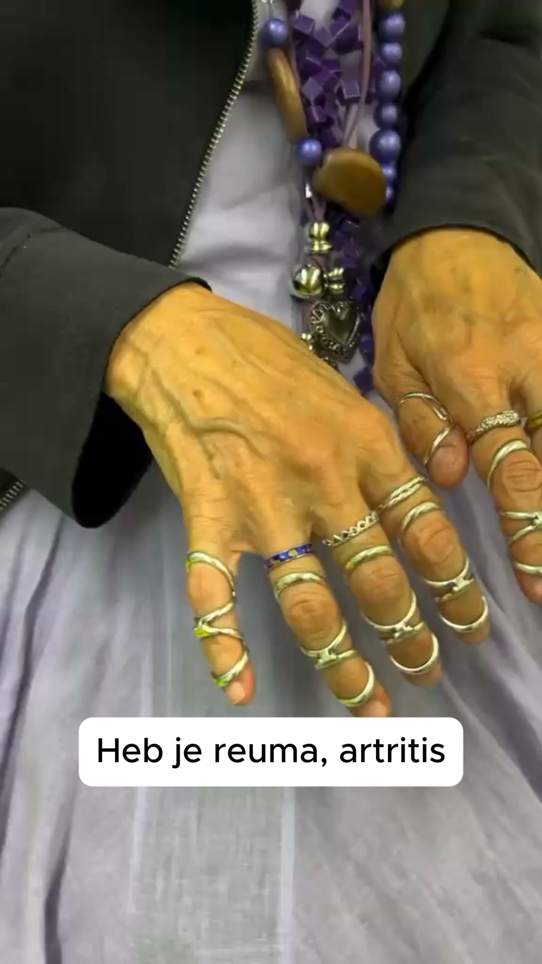 Je handen soepel en pijnvrij met de met de 3-in-1 Novren WarmRelief™ Handschoen