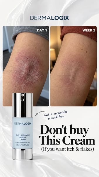 Dermalogix Oat + Ceramide Barrier Cream: calms dry, itchy, eczema-prone skin and rebuilds the barrier.