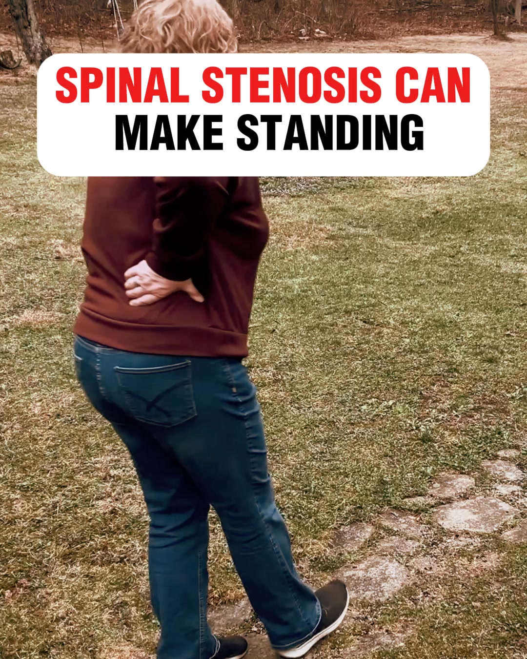 New Spinal Stenosis Discovery