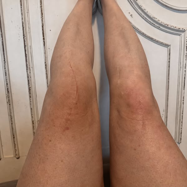 Knee Pain? Read this