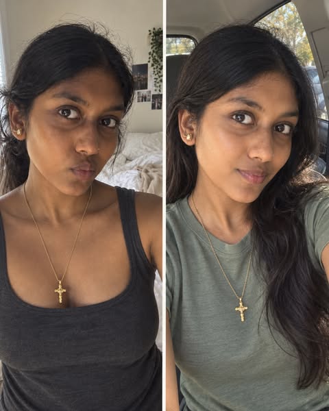 Wishing My Skin Looked More Even