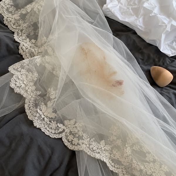I’m getting married soon, and I finally feel good about my skin