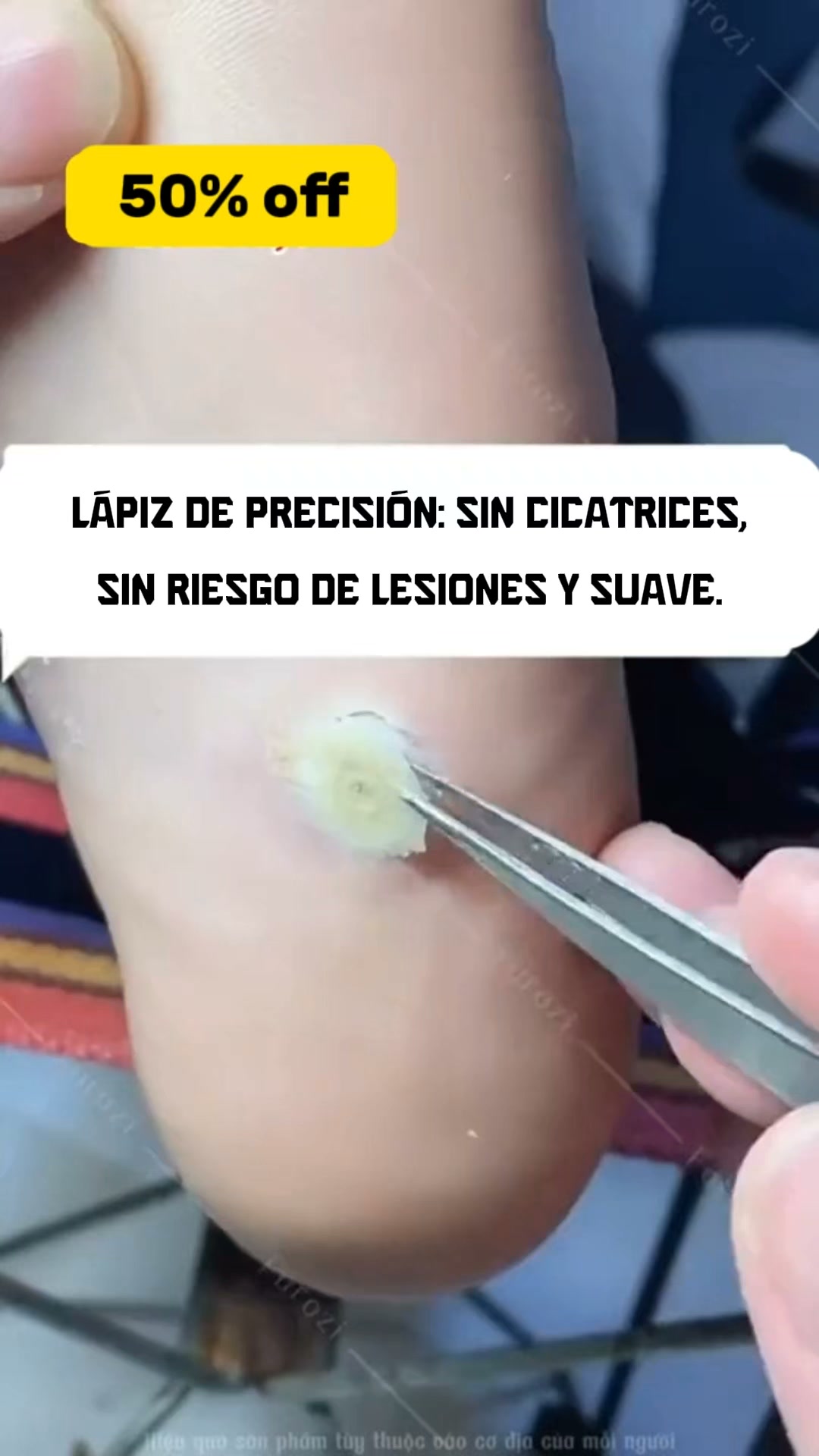 Cuida esas imperfecciones de la piel... sin salir de casa