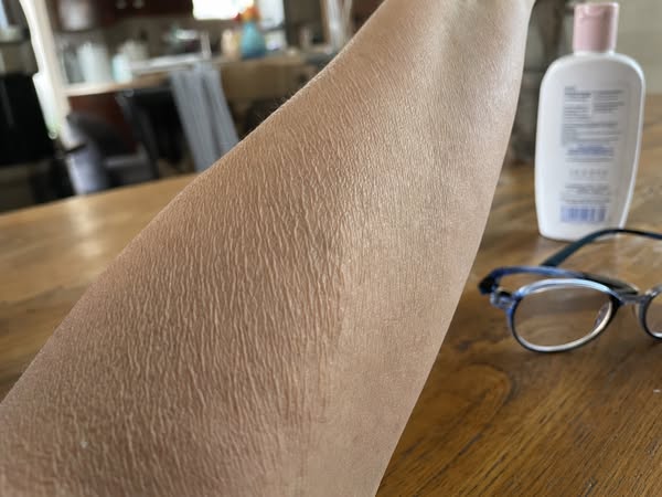 Crepey Skin? Read this...