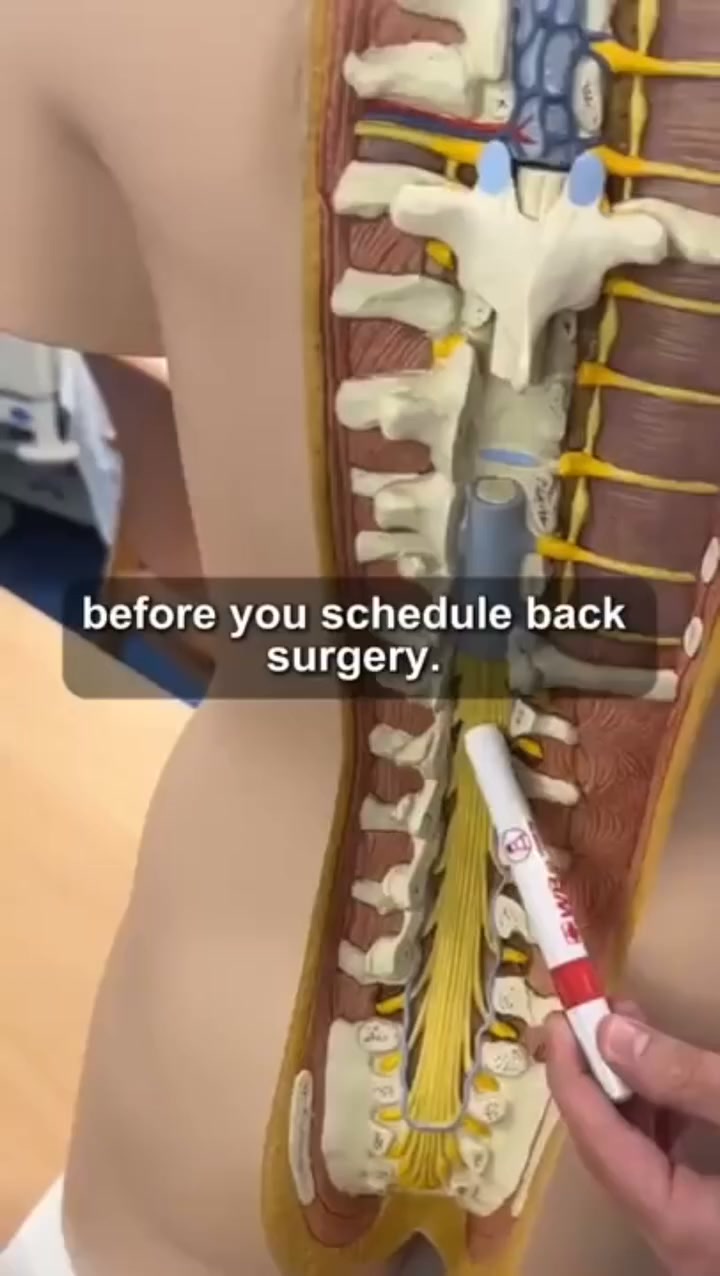 NO MORE BACK PAIN